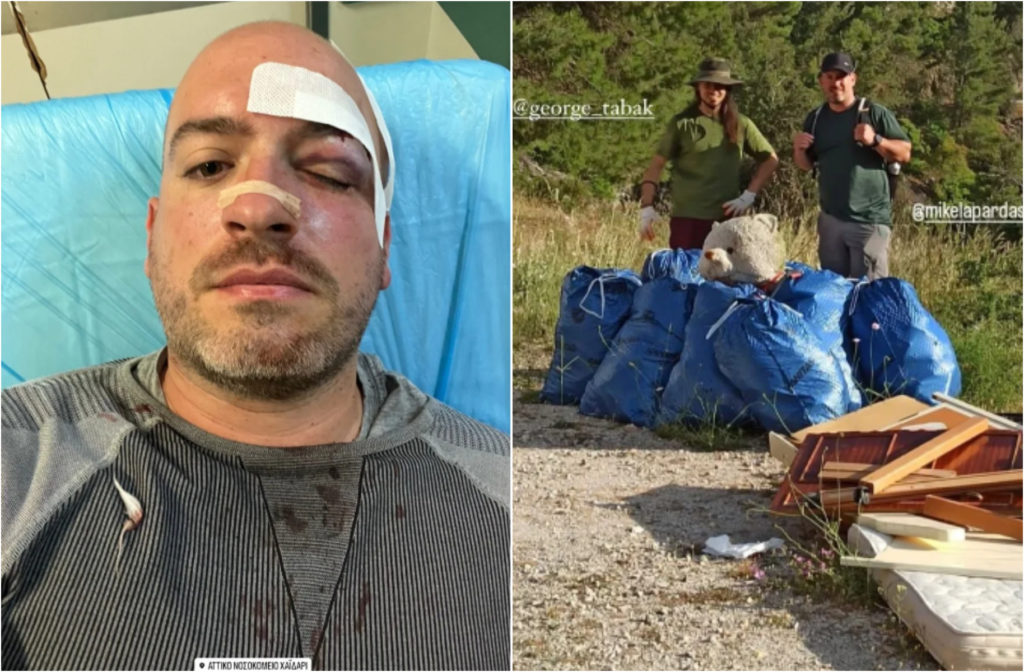Πάρνηθα: Ξυλοκόπησαν άγρια και μαχαίρωσαν εθελοντές που καθάριζαν την περιοχή