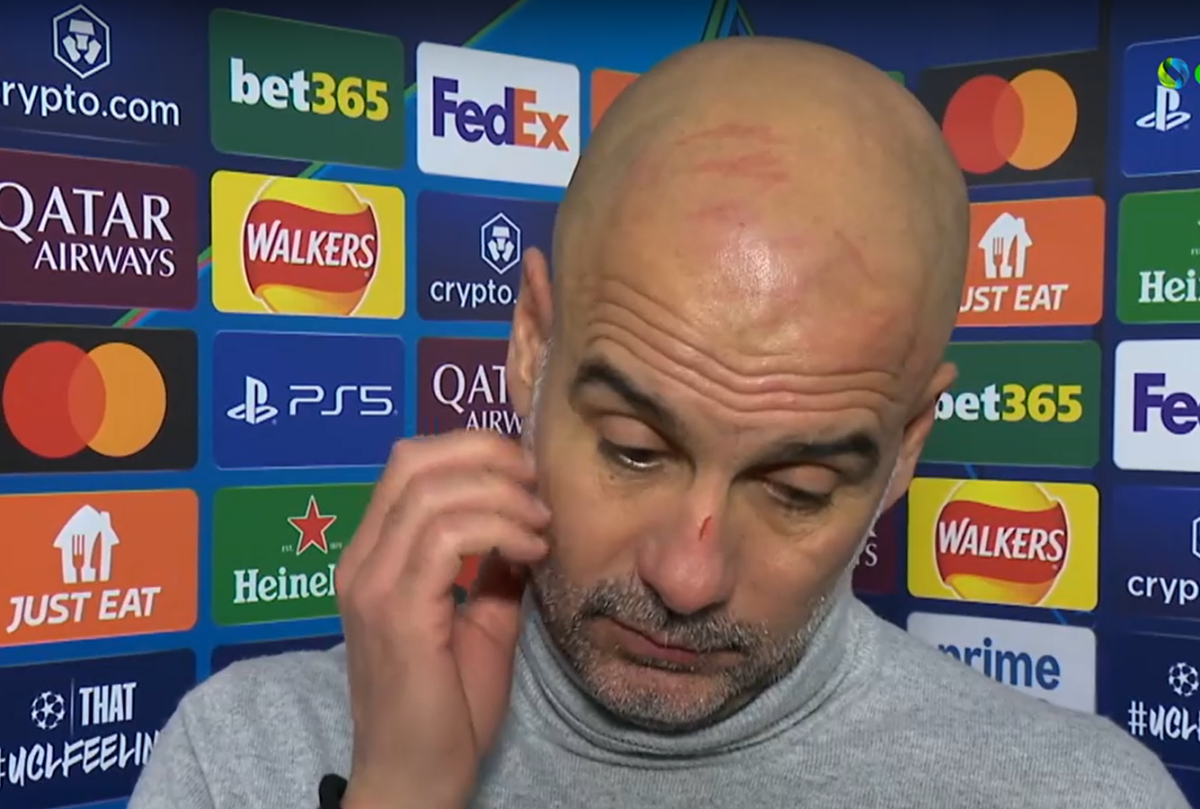 Pep Guardiola: With… bruises on his face after the fight with Feyenoord – What he answered himself (Videos)
 –